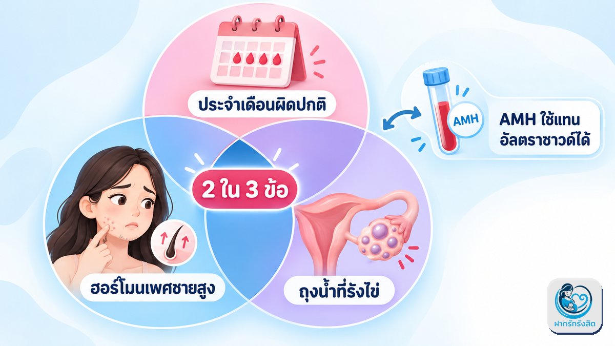 คุณหมอวินิจฉัย PCOS อย่างไร