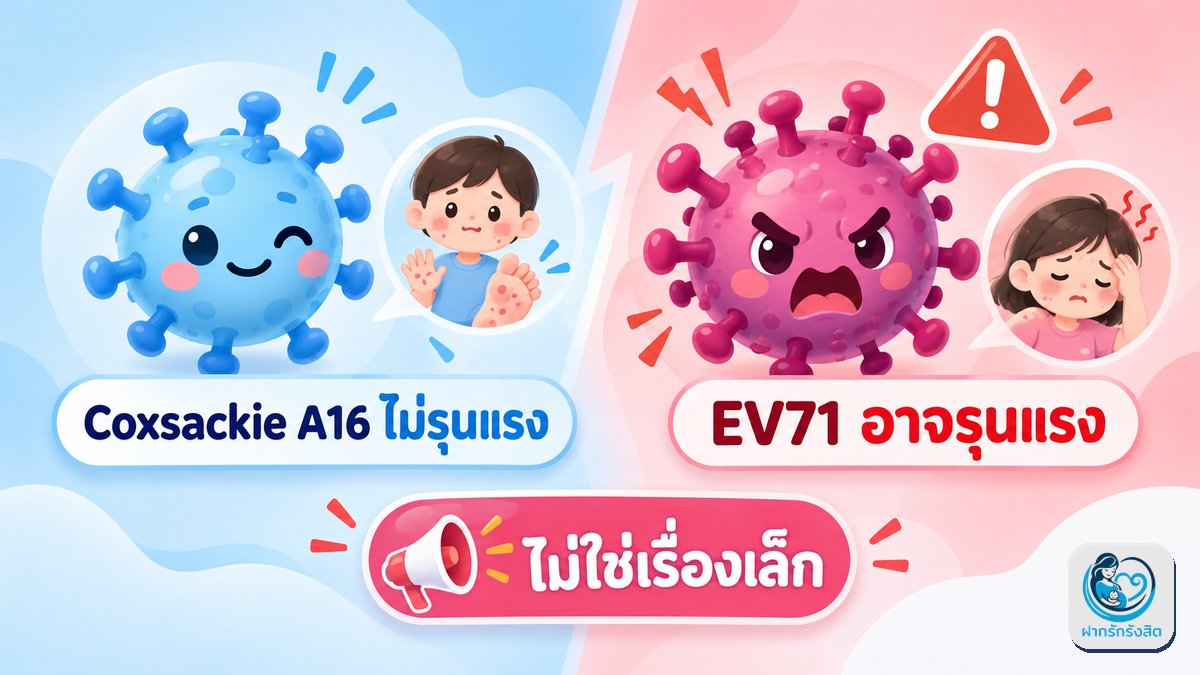 EV71 สายพันธุ์ที่ทำให้มือเท้าปาก “ไม่ใช่เรื่องเล็ก”