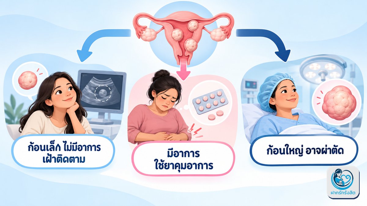 แนวทางรักษา — ไม่ใช่ทุกคนต้องผ่าตัด