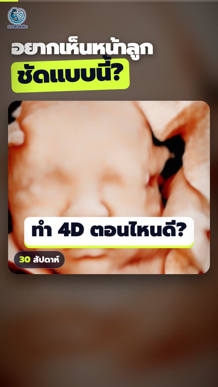 ทำ 4D ตอนไหน ถึงเห็นหน้าลูกชัดที่สุด