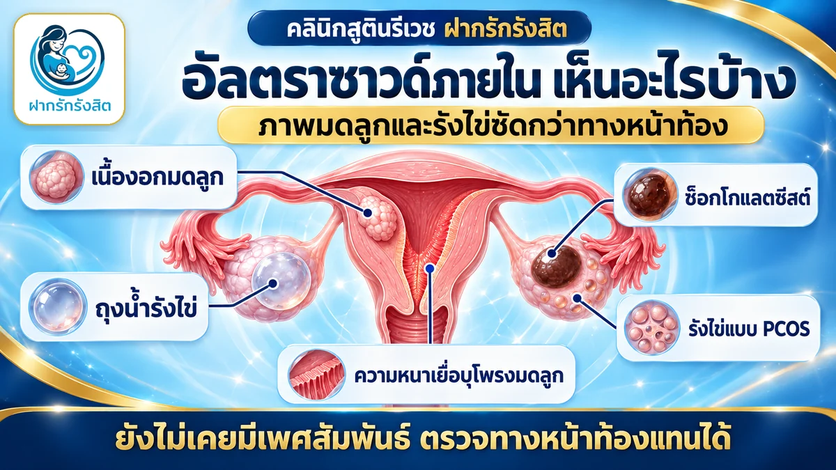 อัลตราซาวด์ภายในเห็นอะไรบ้าง เนื้องอกมดลูก ถุงน้ำรังไข่ ช็อกโกแลตซีสต์ PCOS — อัลตราซาวด์ภายใน รังสิต